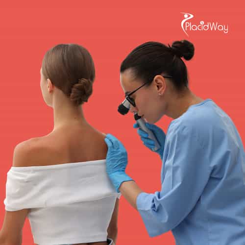 Melanoma Immunotherapy in Mexico: Trends, Patient FAQs, and Success Stories